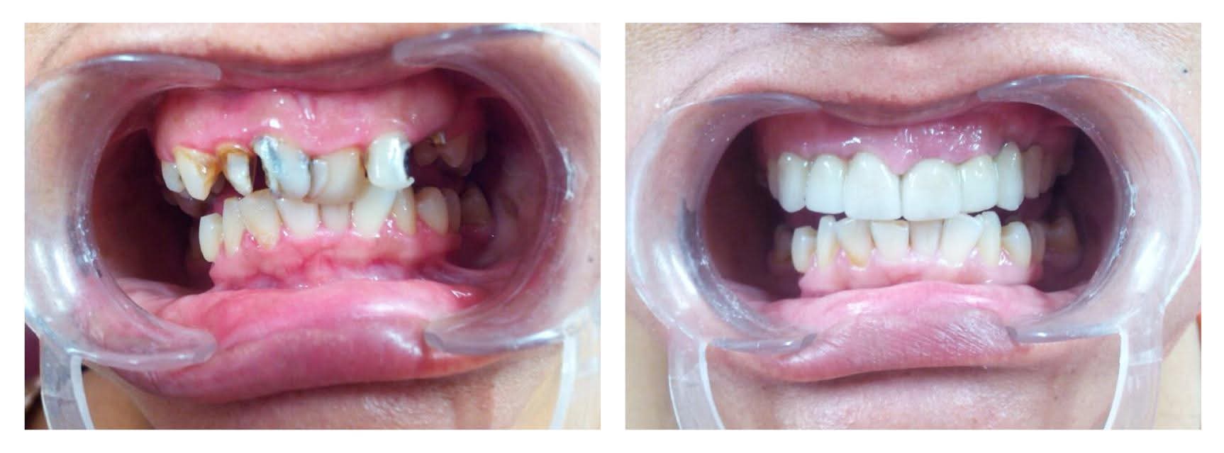 Case 02 — selected dental treatment result